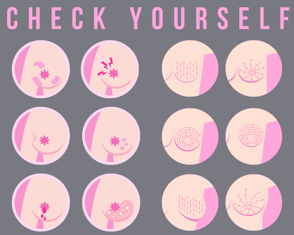 How to Do a Breast Self-Exam at Home